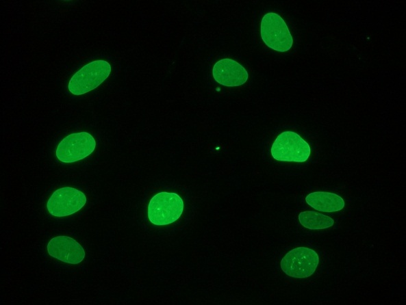 Figure 1 Immunocytochemical staining of fiboblasts showing nuclear lamina